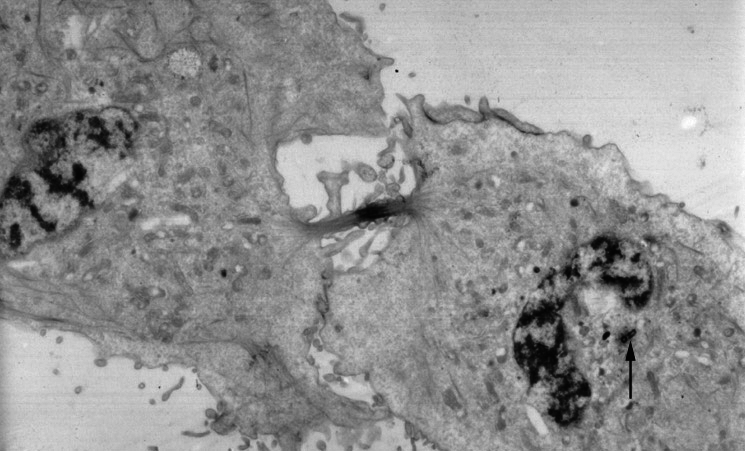 Black and white photograph taken through an electron microscope. It shows a cell which has almost finished dividing into two cells. Each of the new cells has a nucleus. They are still connected together at one point.