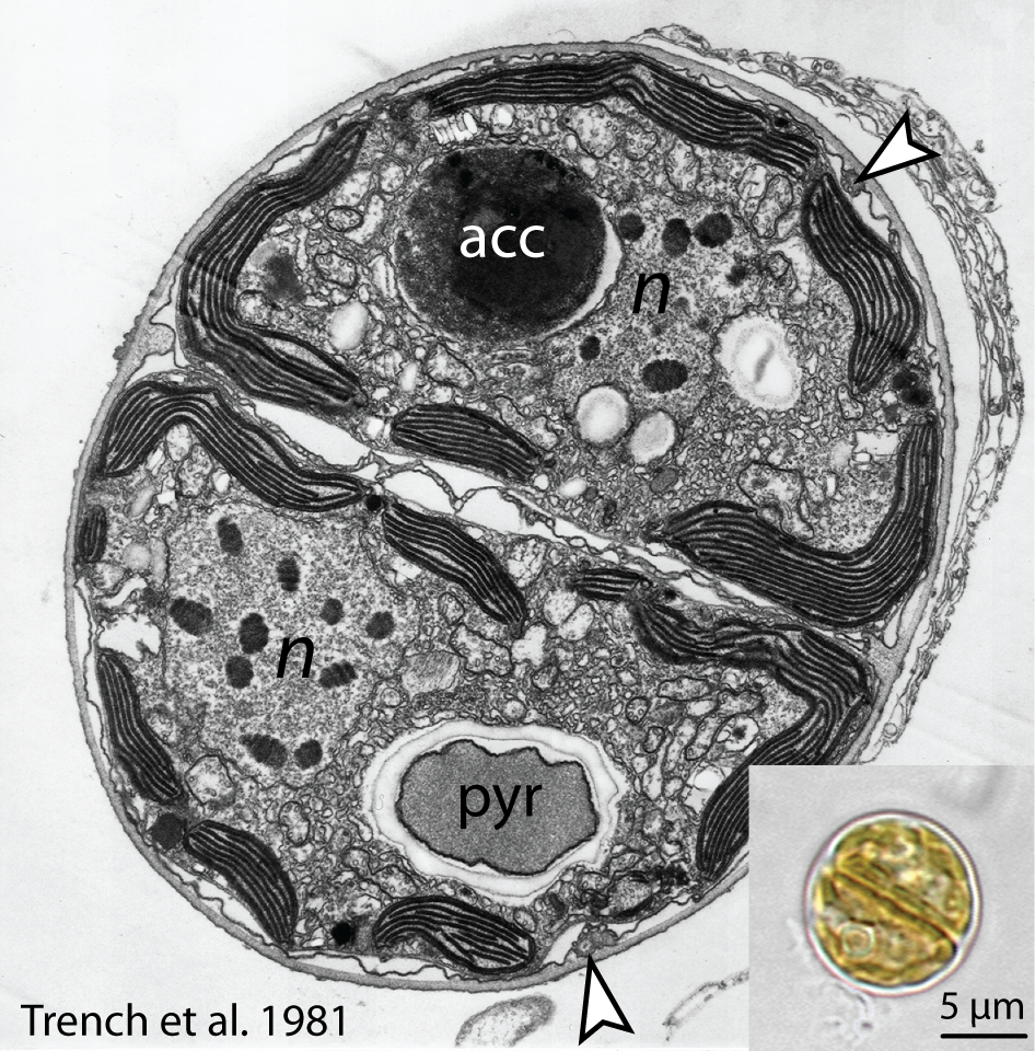 Electron microscope image of a cell in the process of dividing. It is a black and white image. The cell is a unicellular organism. In the bottom right corner there is a smaller image of a cell at the same stage of division. This image is in colour and was captured using a light microscope.