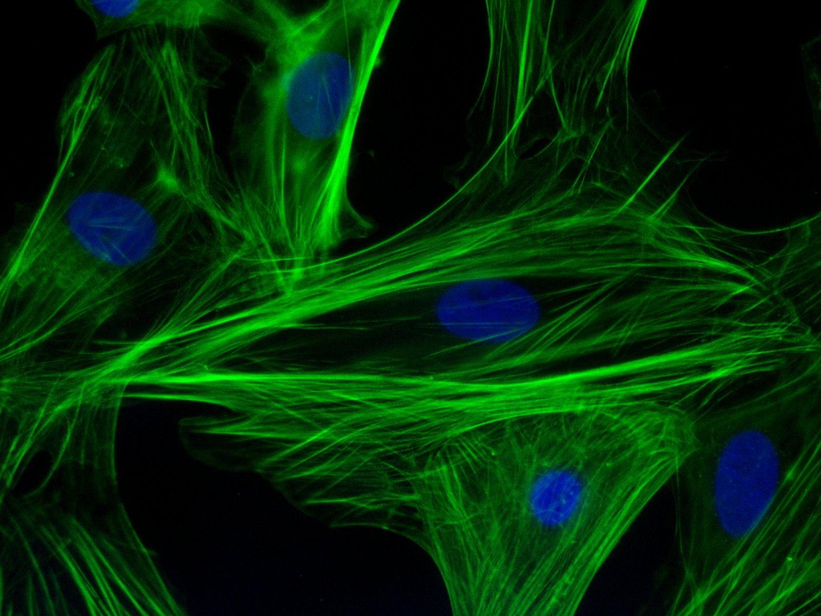 Microscope image of heart muscle cells. The cells are on a black background. The outlines of the cells are not visible. All that is visible are green lines and blue ovals. The blue ovals are the nuclei of the cells. The green lines are structural protein filaments inside the cells. Each cell contains many of these filaments, running roughly parallel to each other. The shape of each cell can be inferred from the way the structural protein filaments are distributed.