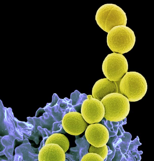 Electron microscope image of bacterial cells. Each cell appears roughly spherical in shape. They have been coloured in yellow using a computer. Behind them there is a large, purple cell. This is actually a white blood cell which is in the process of engulfing the bacterial cells.