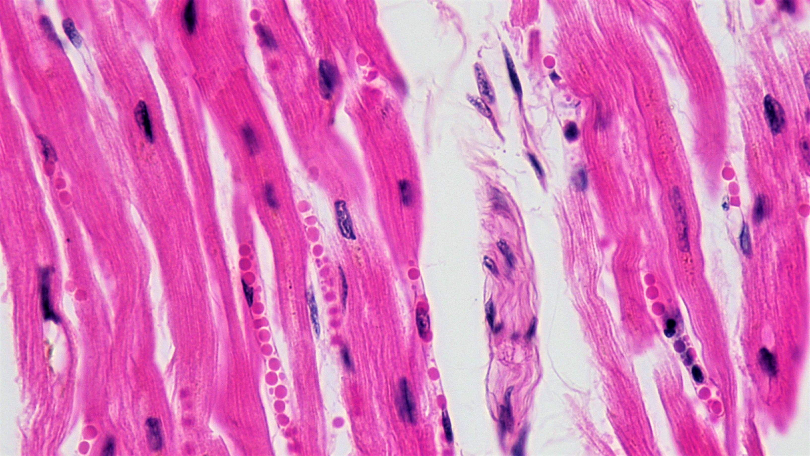 Microscope image of heart muscle cells. It has been stained so that the cytoplasm shows up as pink and the nuclei show up as blue. The cells are long and thin and lined up alongside each other, with gaps between them in some places.