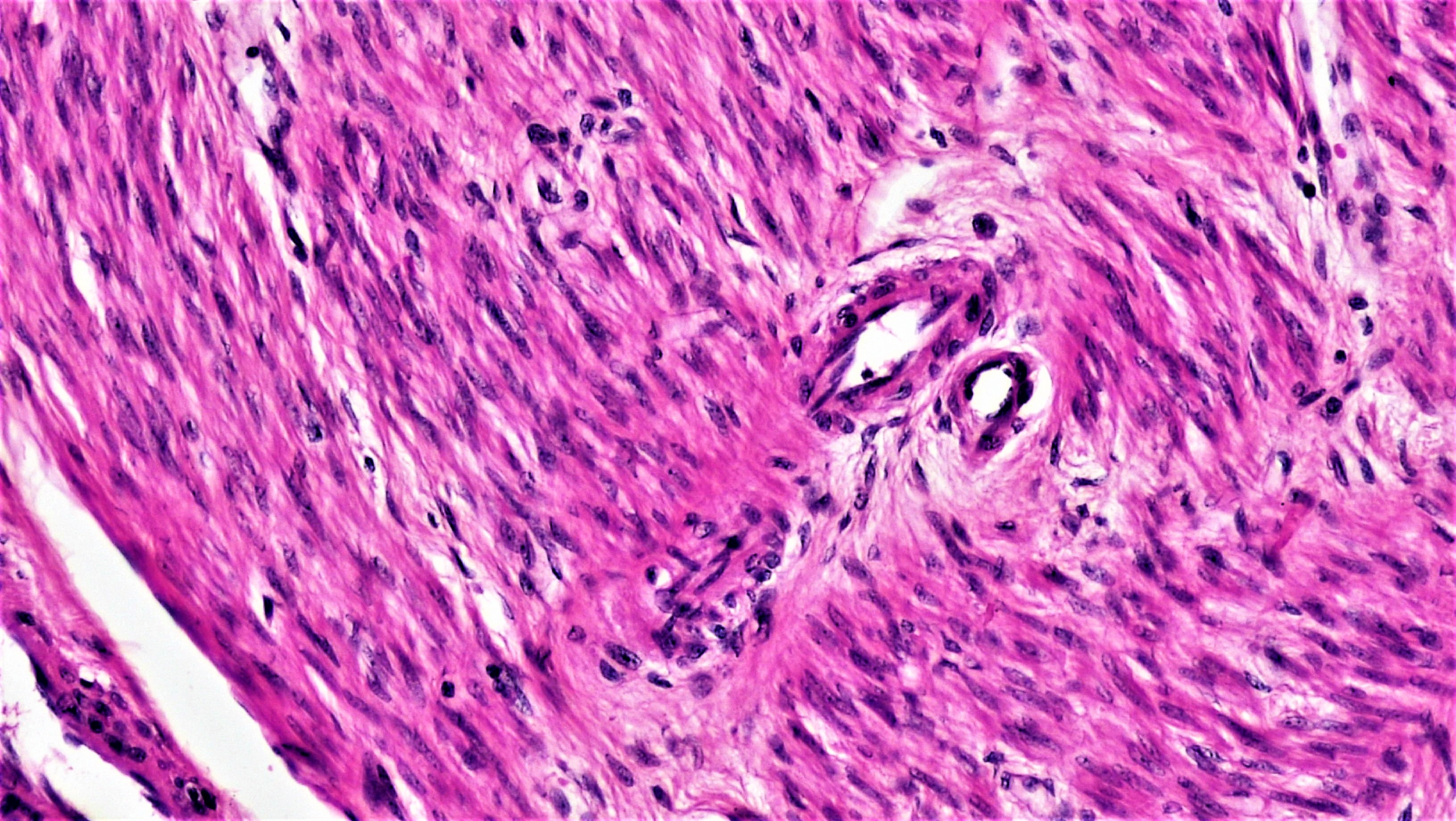 Microscope image of muscle tissue. The many individual muscle cells that make it up can be seen.