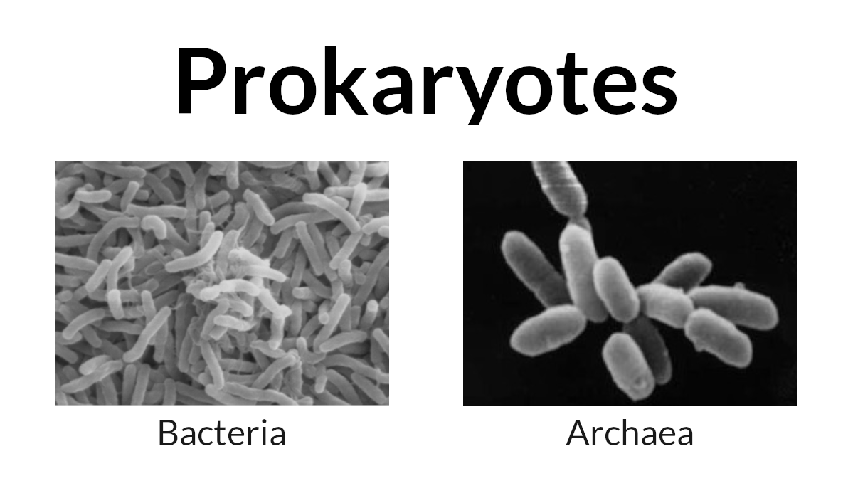 Images of the two types of prokaryotes: bacteria and archaea. The title says "Prokaryotes". Below that are two black and white images of cells. The one on the left is an image of bacterial cells and is labelled "bacteria". The one on the right is an image of archaea cells and is labelled "archaea".
