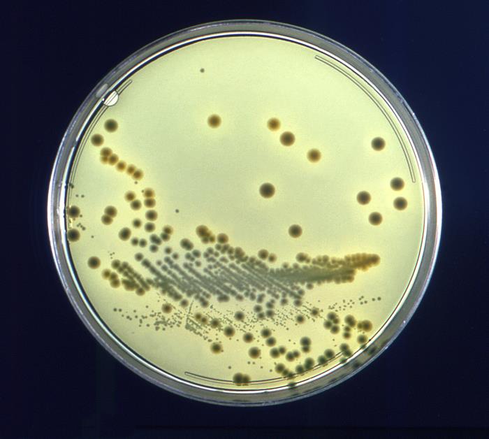 Photograph of an agar gel plate with bacterial colonies growing on it. The plate is a circular Petri dish. The agar is a greeny yellowing substance that fills the plate. The bacterial colonies appear as dark green/blue circles on the surface of the agar. They very in size. Many of them are lined up in rows with each other.