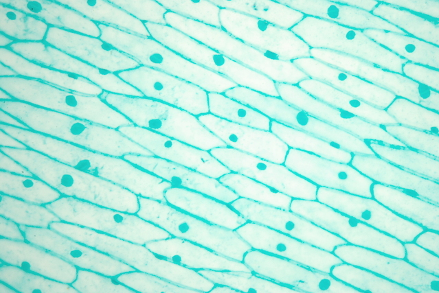 Image captured through a light microscope. It shows a large number of leaf cells, each one with a cell wall and a nucleus, which have both been stained green. The wall of each cell has an elongated geometrical shape, with about 5 to 7 straight edges. The cells are arranged roughly in rows.