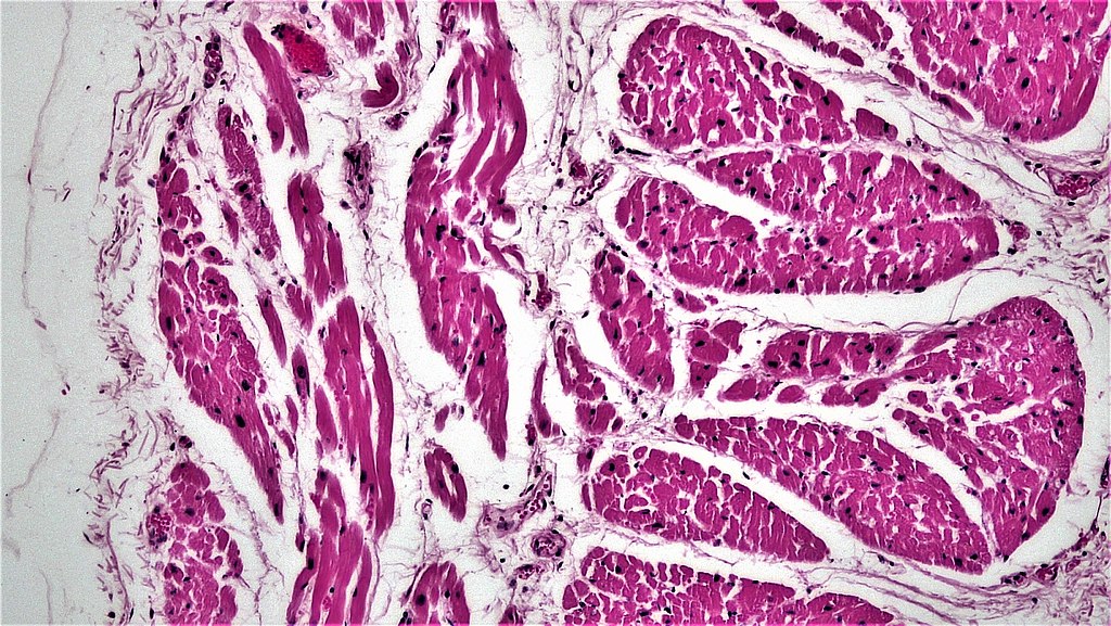 Photograph taken through a microscope of heart muscle tissue.