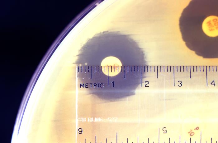 Photograph of a scientist measuring the diameter of the clear region around an antibiotic disc. A ruler is shown held up to the clear region, and it can be seen that the clear region's diameter is 22 millimetres.