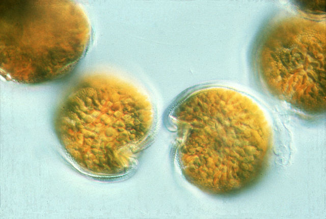 Microscope image of single-celled algae. The image is of a few algal cells on a blue background. Each cell appears roughly circular in shape.